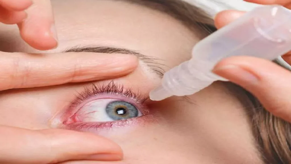 Eye Flu in India