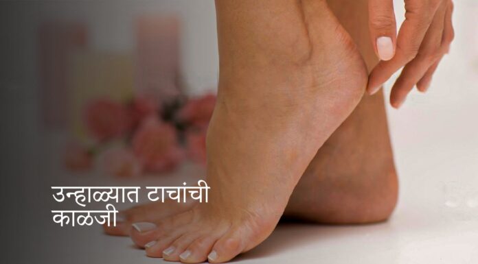 उन्हाळ्यात टाचांची काळजी | Summer heel care | उन्हाळ्यात टाचांची काळजी |