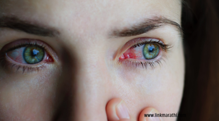 Eye Flu in India:भारतात Eye फ्लूचा उद्रेक,सावध रहा डॉक्टरांनी सावधानतेचा इशारा दिला|Eye flu outbreak in India, be careful, doctors warned caution Eye Flu in India