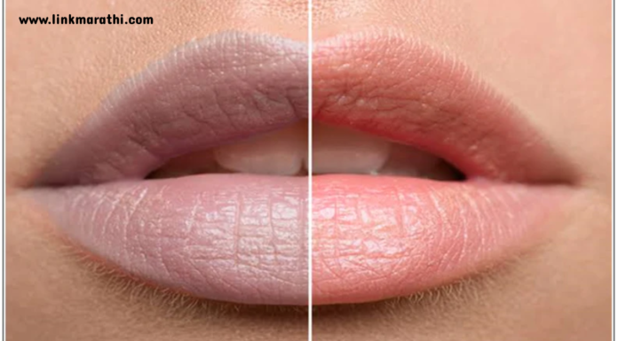 Lighten Dark Lips:तुमची ओठ काळे झालेत का? नैसर्गिक उपाय आणि बरेच काही!|Are your lips black? Natural Remedies and More! Lighten dark lips