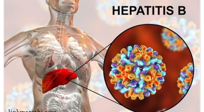 World Hepatitis Day:हिपॅटायटीस बी आणि त्याच्या प्रसाराच्या पद्धती|Hepatitis B and Its Modes of Transmission World Hepatitis Day