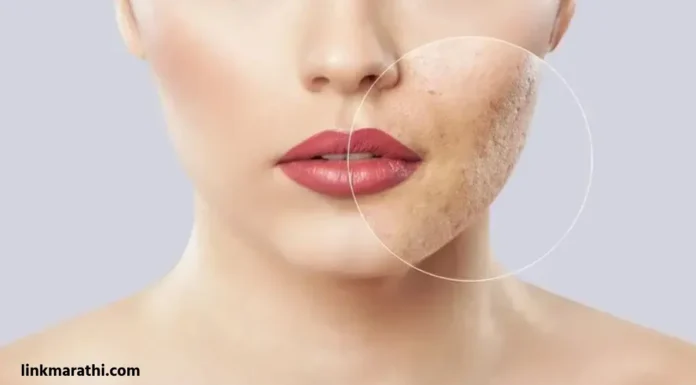 Skin care:चेहऱ्यावरील ओपन पोर्स कमी करण्याच्या प्रभावी घरगुती उपाय | Effective home remedies to reduce open pores on face Skin care