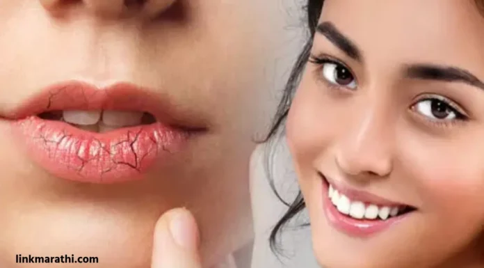Winter Lip Care:हिवाळ्यात तुमचे ओठ ओलसर आणि लवचिक ठेवण्यासाठी ५ टिप्स | 5 tips to keep your lips moist and supple in winter Winter Lip Care